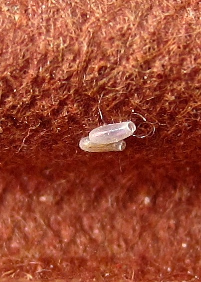 Bed Bug Eggs